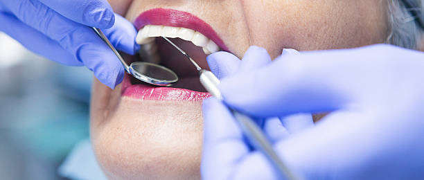 Best Emergency Denture Repair in Altoona, IA